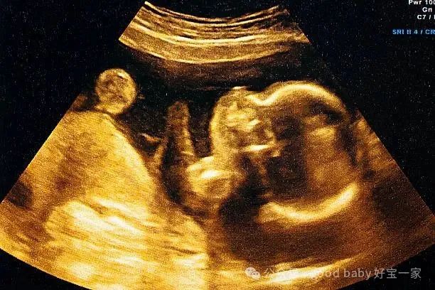 ultrasound of a woman's fetus at 37 weeks - 胚胎 個照片及圖片檔